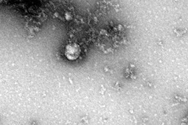 Vì sao biến chủng SARS-CoV-2 lây lan nhanh ở Việt Nam?